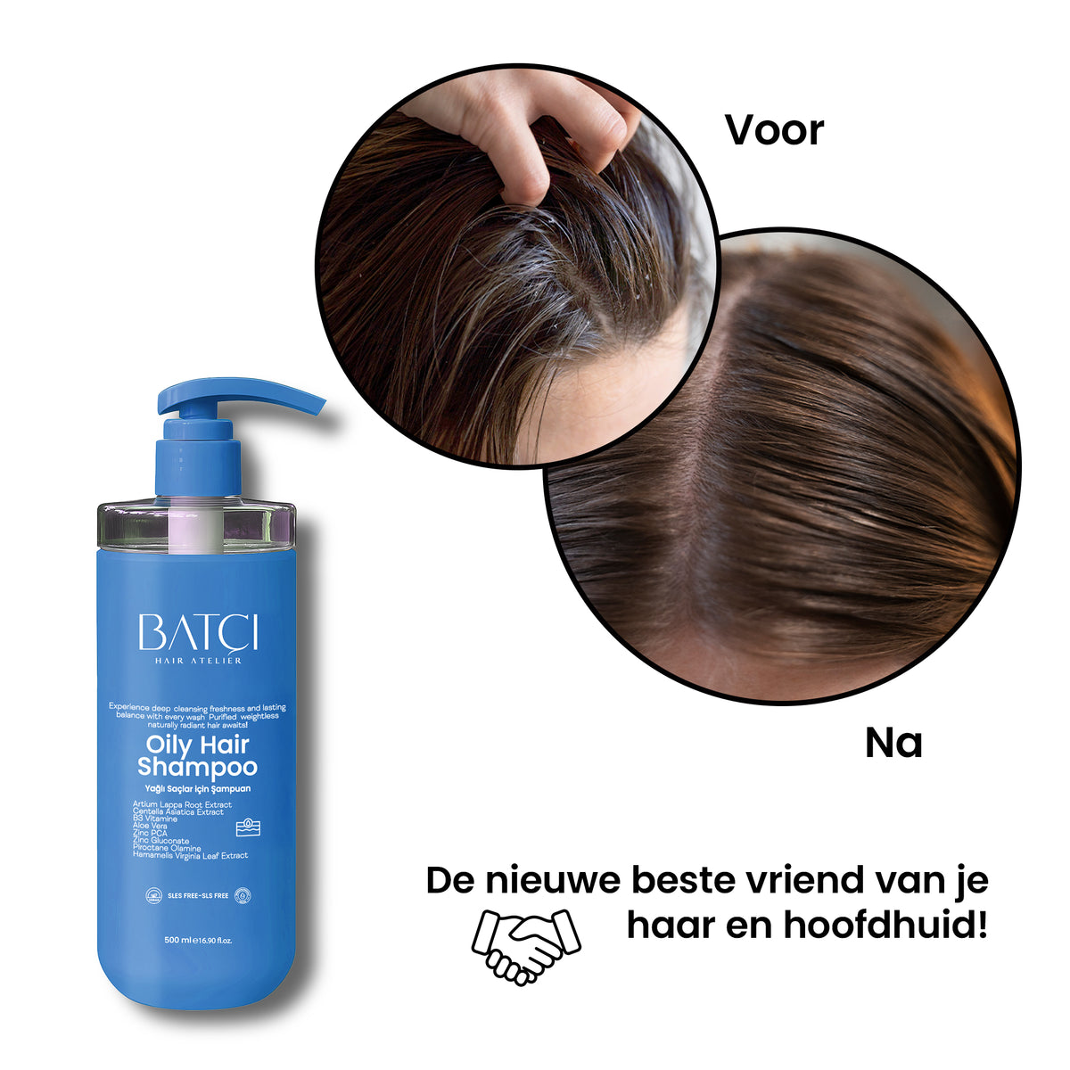 Before and after: fresher, less oily hair with sebum balancing shampoo
