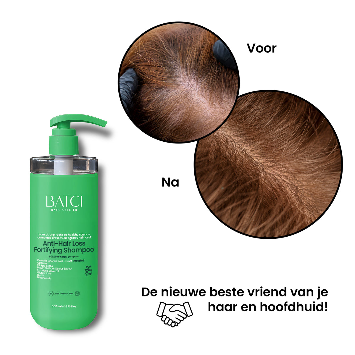 Before and after: stronger, denser-looking hair with anti hair loss shampoo